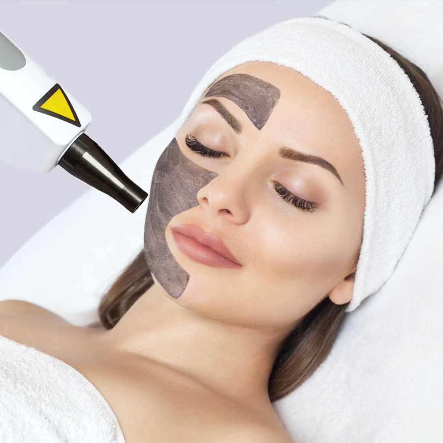 carbon_laser_facial_01